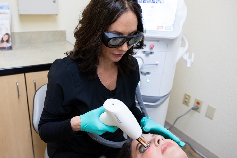 Laser Services